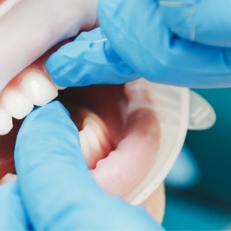 close-up-of-female-mouth-with-retractor-doctor-PWRQ6FA